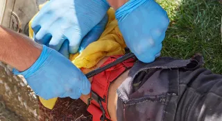 How to Apply a Tourniquet