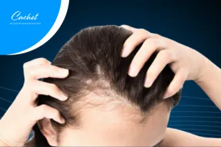 Feeling Lost with Hair Loss?  Let’s Find the Best Solutions Together!