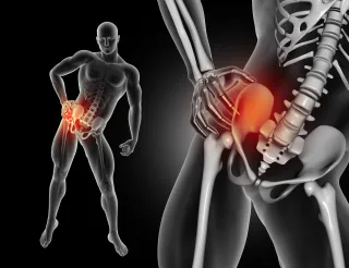Strengthen Your Hips: Exercises to Prevent and Reduce Pain