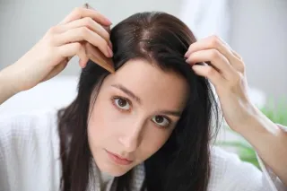 Why You Have Dandruff: 5 Surprising Reasons and How to Fix Them