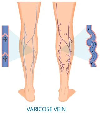10 Signs You Need to See a Leg Doctor: Don’t Ignore These Warning Symptoms!