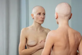 When Your Body Doesn’t Feel Like Yours Anymore: Healing Body Image After Cancer