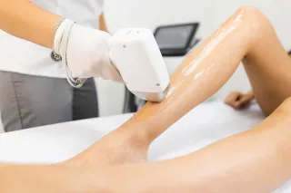Is laser hair removal safe?