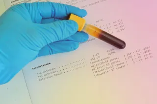 Decoding Testosterone Reference Ranges: Your Health Beyond the Average