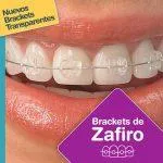 Brackets Dentales de Zafiro: La manera más discreta de lograr una linda sonrisa.