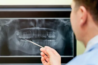 Unlock Your Smile’s Potential: The Power of Digital X-Rays in Dental Care