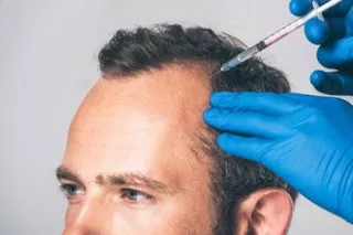 Stem Cells for Hair Rejuvenation: Unlocking the Future of Hair Restoration