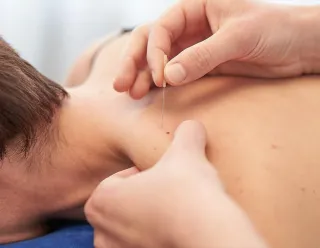 What is Dry Needling and How does it work?