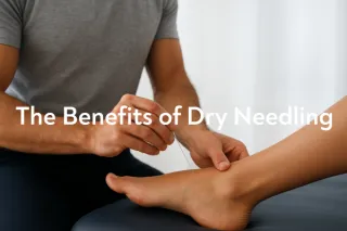 The Benefits of Dry Needling