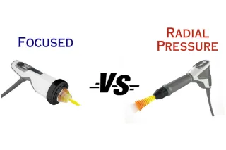 Best Practices - Focused Shockwave or Radial Pressure