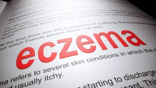 Eczema During Menopause: Understanding the Connection and How to Manage It Naturally