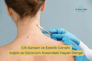 Cilt Kanseri Tedavisinde Estetik Cerrahinin Rolü | Dr. Bülent Çığşar
