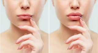 Lip Flip: The Secret to a Fuller Pout Without Fillers -