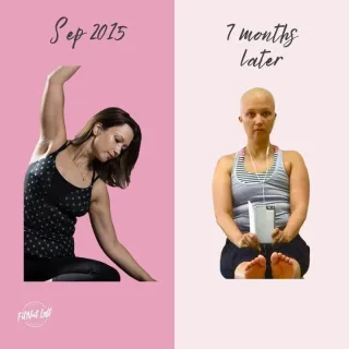 Breast Cancer Can Happen to Anyone: My Personal Journey and Why Early Detection is Key