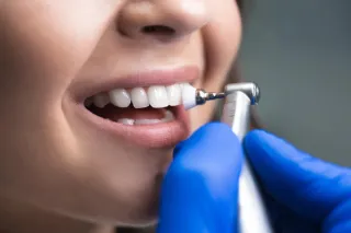 The Importance of Regular Dental Cleanings and Exams
