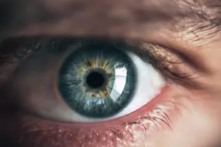 Iridology