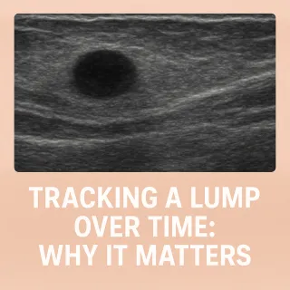 Tracking a Lump Over Time: Why It Matters