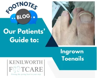 The Agony of an Ingrown Toenail
