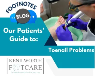 Embrace Your Toes: A Guide To Overcoming Toenail Embarrassment