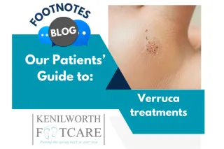 The Complete Guide to Verruca Treatments in Kenilworth: Advanced Solutions at Kenilworth Footcare