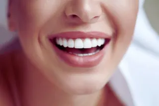 Unveiling a Brighter Smile: The Professional Journey of Teeth Whitening