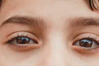 At-Home Therapy Reduces Symptoms of Binocular Vision Disorders