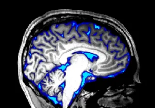 Visual Stimulation Changes Fluid Flow in the Brain