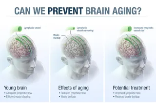 Researchers Find Missing Link Between the Brain and Immune System