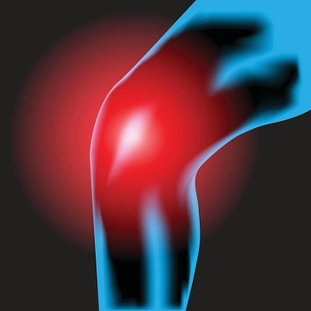 Knee Arthritis Relief: 3 Critical Ingredients For Success