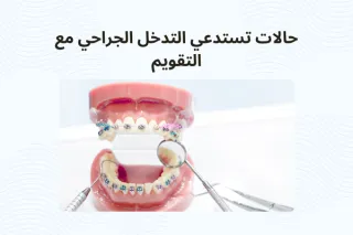 حالات تستدعي التدخل الجراحي مع التقويم