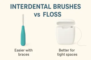 Interdental Brushes vs. Floss: Which Is Easier and More Effective?