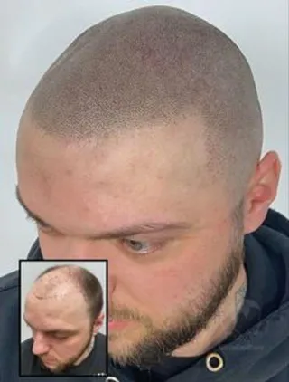 FAQ image