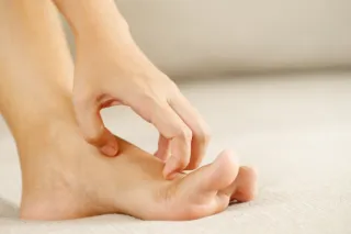 Why Athlete’s Foot Keeps Coming Back—and How to Stop It