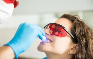 Blanqueamiento dental: No es oro todo lo que reluce