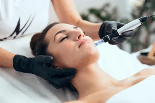 5 Key Benefits Microneedling Treatments For Acne