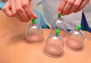 Cupping Therapy in Towson, MD: Ancient Healing Meets Modern Wellness at TheraMove