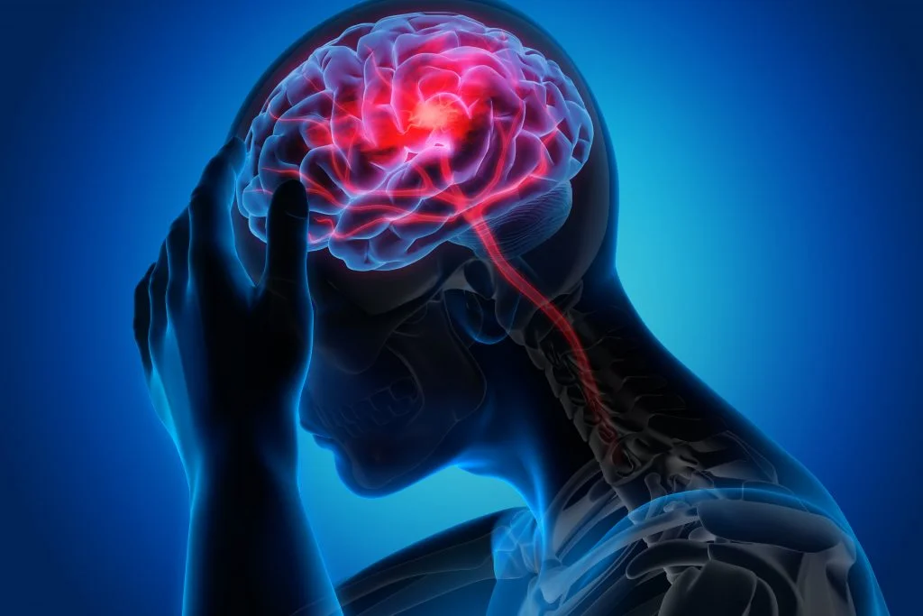 Silent Stroke Detected Thanks to BICOM® BodyCheck