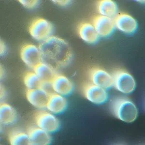 Live and Dry Blood Analysis