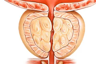 What Every Man Should Know About Long-Term Health