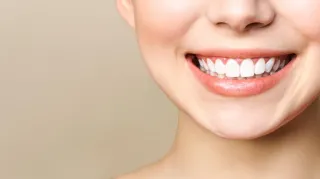 Cum pot menține rezultatele albirii dentare pe termen lung?