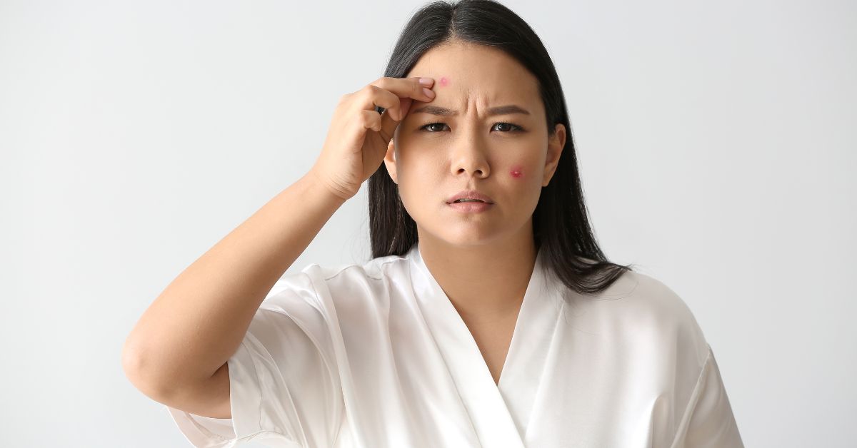 From Acne to Pigmentation — Why Aerolase Is the Future of Laser Skin Care