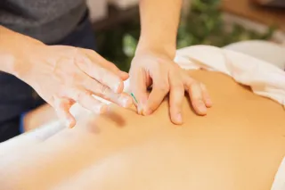 Acupuncture for Pain Relief: What to Expect in Your First Session