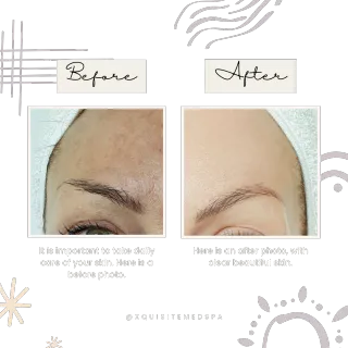 Microblading vs. Powder Brows: Which is Right for Your Eyebrows?