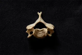 Effective Chiropractic Treatments for Sciatica Relief