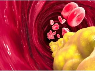 All You Need To Know To Reduce Cholesterol