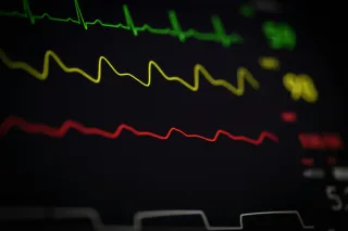 The 13-Week Cash Flow That Actually Gets Used: Your "Oh Shit, Where's My Money?" Insurance Policy