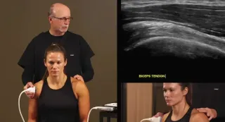 4 Valuable Ways MSK Ultrasound Could Benefit Your Practice or Career