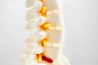 Spinal Decompression