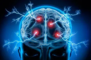 The Brain Filter That Changed My Business