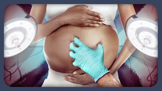 Unrecognised Violence: when women face obstetric abuse in childbirth